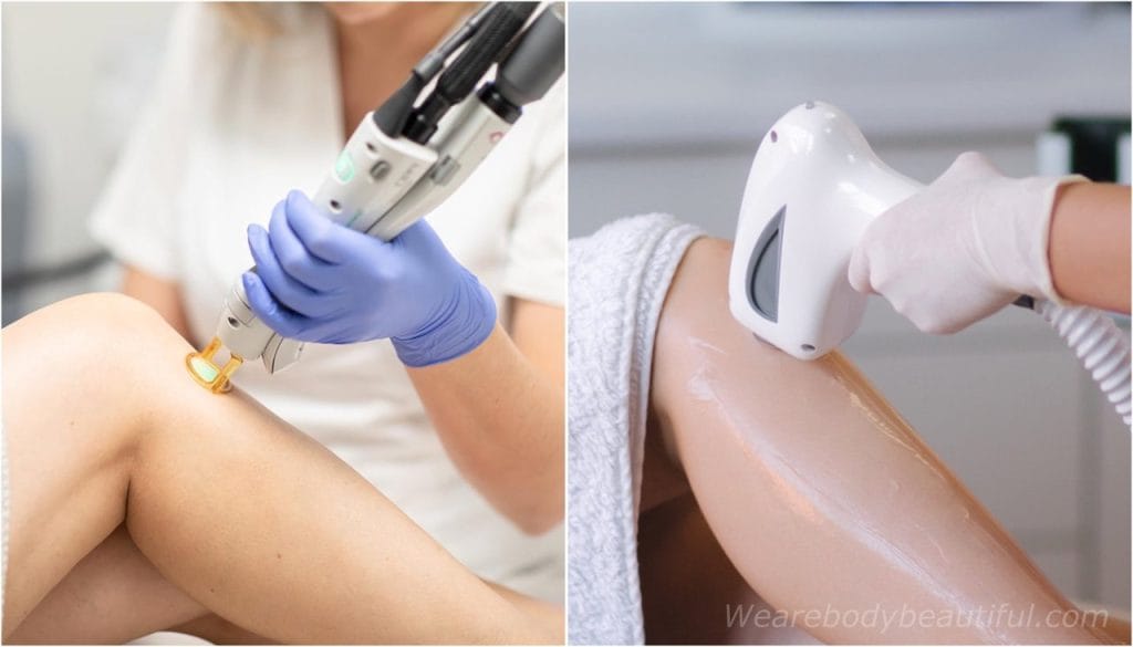 Ipl Hair Removal Device Vs Laser